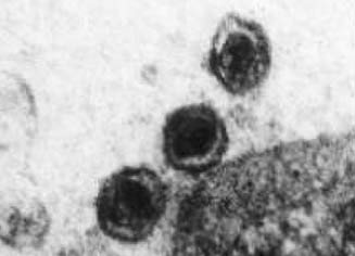 Virus PPC al microscopio electr�nico de transmisi�n