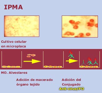ipma