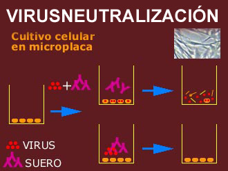 virusne
