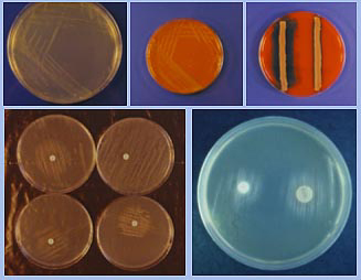 agar