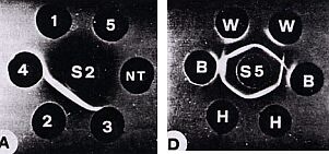 Inmunodifusi&oacute;n para la tipificaci&oacute;n de H. parasuis