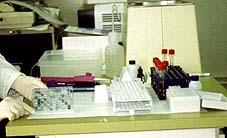 Required equipment and material for ELISA method.