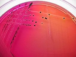 GRAM (-) bacteria