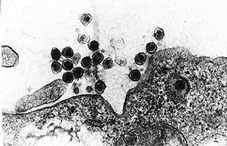 Retrovirus infectando celula porcina