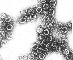 Virus like particle (VLP)