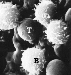 Scanning electron microscope: T and B lymphocytes